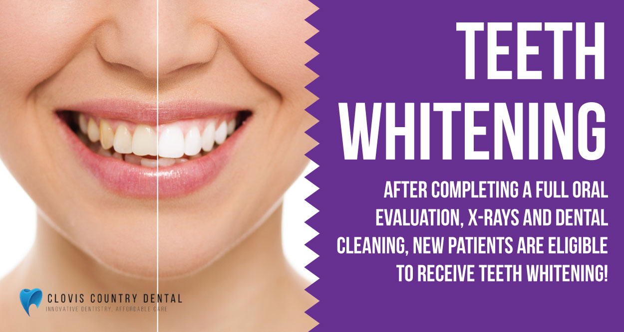 https://cloviscountrydental.com/wp-content/uploads/2025/02/teeth-whitening-special-2.jpg